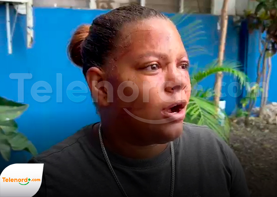 Mujer agredida por otra en SFM pide justicia; madre exige arresto
